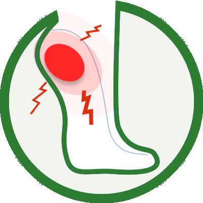 Plantarfasciit